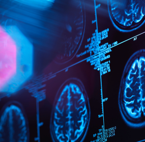 Brain scan